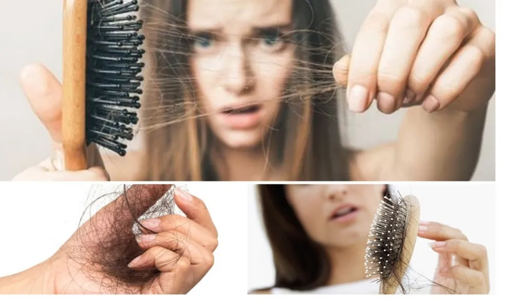 Chia sẻ kinh nghiệm giảm rụng tóc hiệu quả mà các chị em nên lưu ngay! - 3