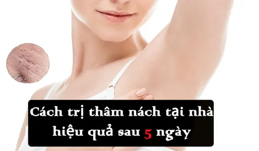 top-15-cach-tri-tham-nach-tai-nha-don-gian-va-hieu-qua-chi-sau-5-ngay