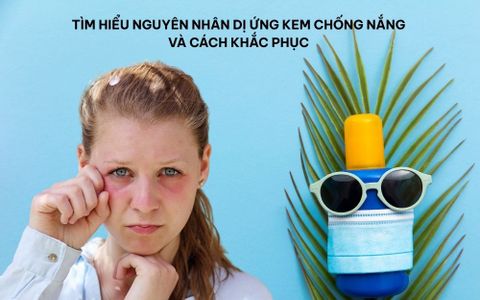 di-ung-kem-chong-nang