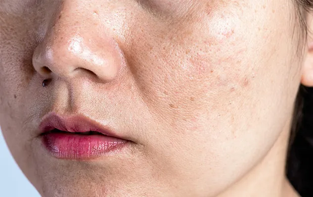 10 Sản phẩm skincare cho da khô lỗ chân lông to chất lượng tốt - 1
