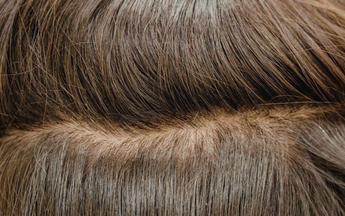Scalp Hair Là Gì? Những Thuật Ngữ Về Scalp Bạn Nên Biết